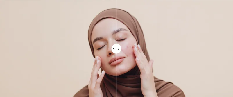 المقارنة - سمة