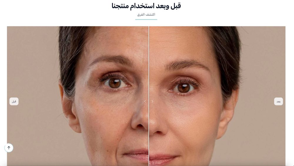 قبل وبعد (سيليا)