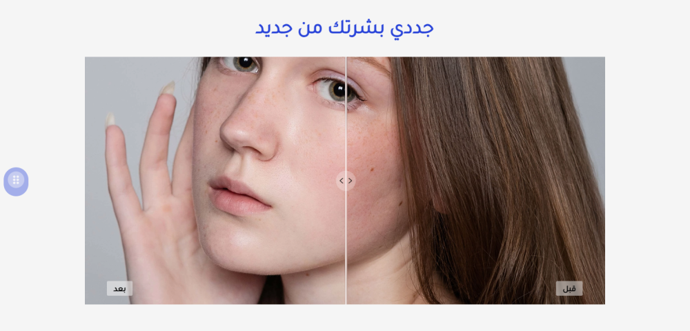 اختلاف المظهر - فلوريزا