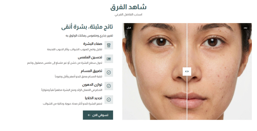 قبل وبعد - نقاء